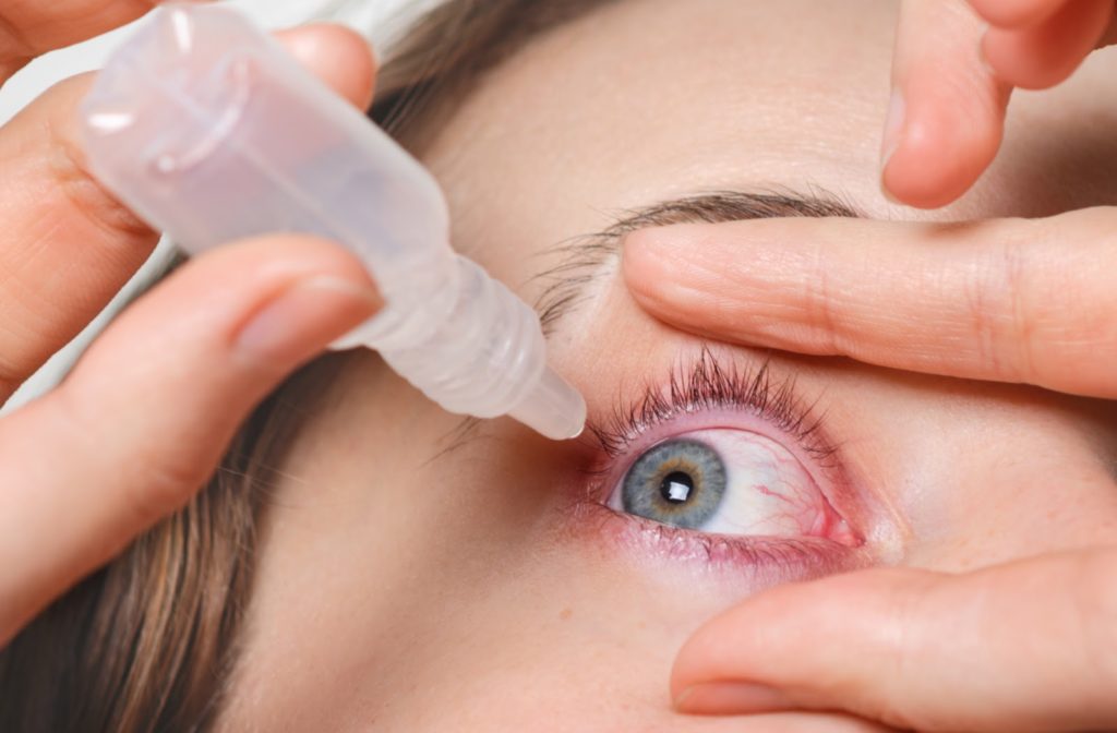 Woman treating eye redness by using lubricating eye drops